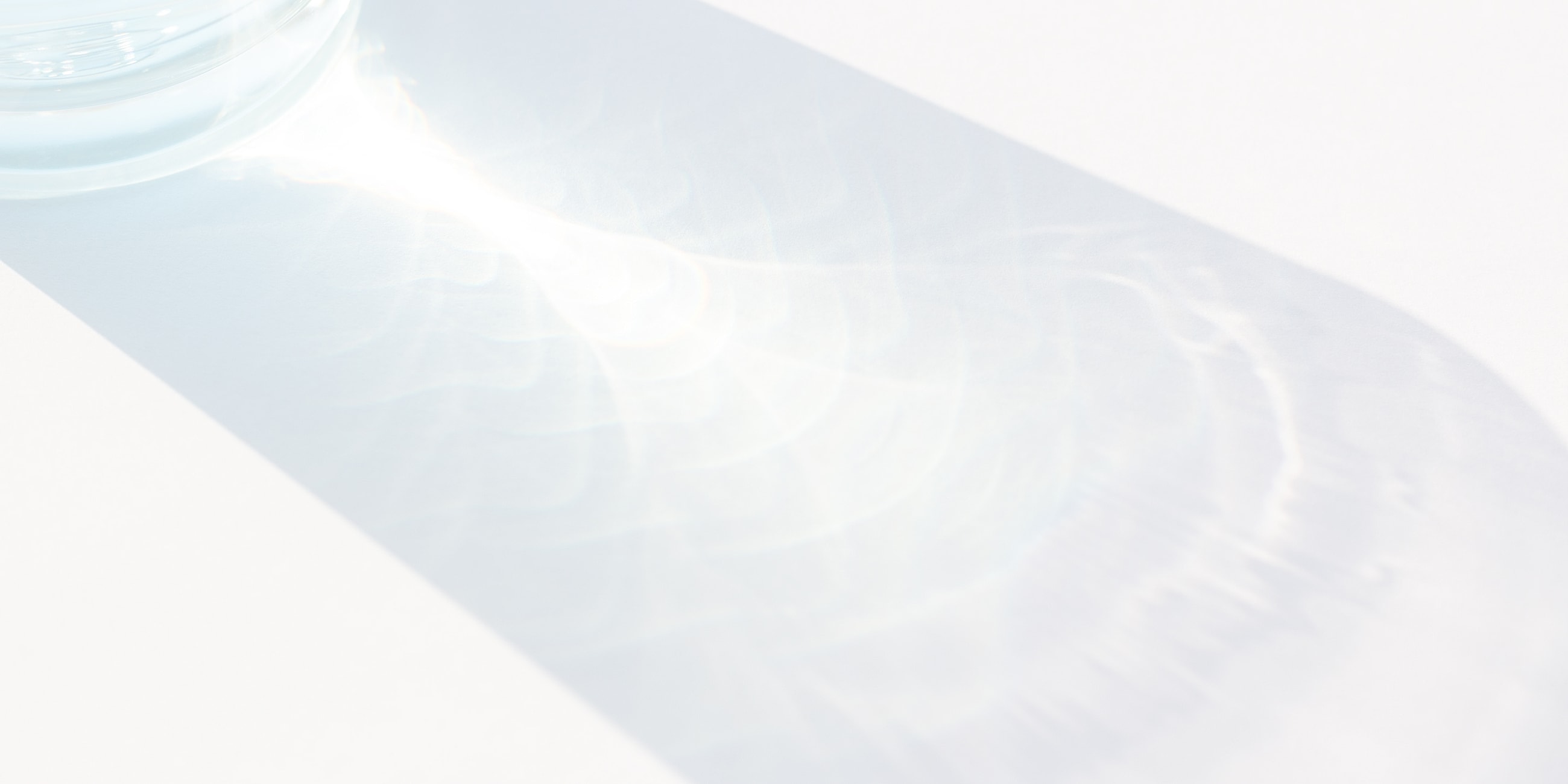 Reflected light creating abstract patterns on surface.