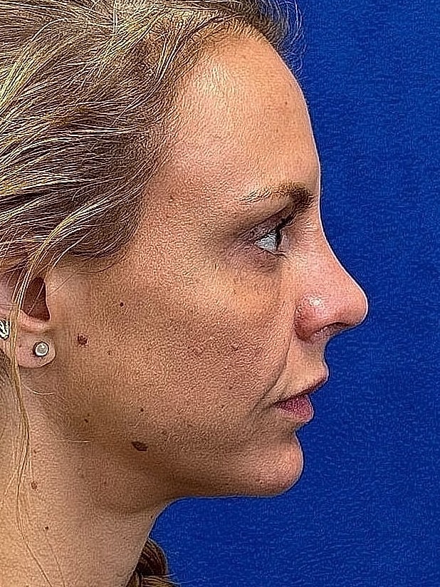 Profile view of a woman with hair pulled back