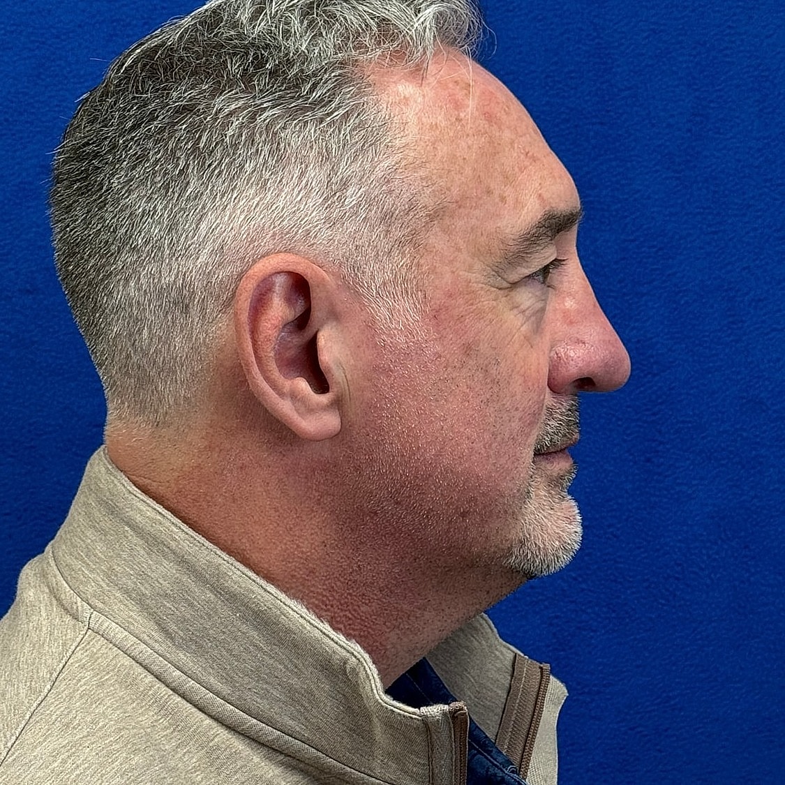 Man in profile with short hair against blue background
