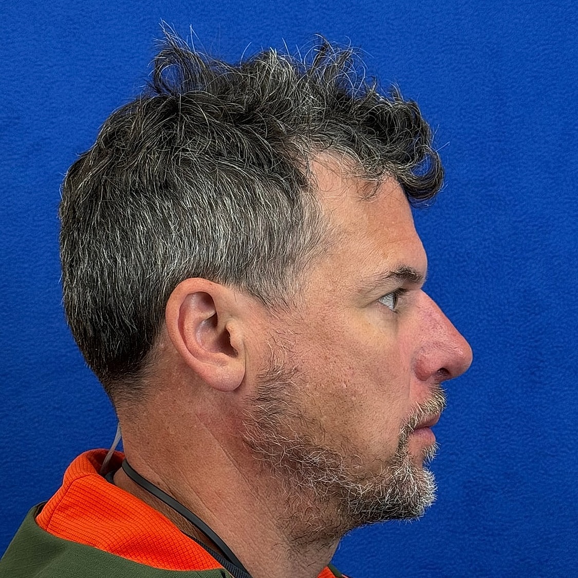 Profile of a man with short, textured hair.