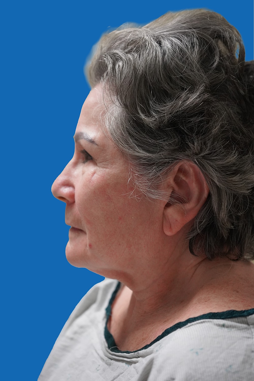 Profile of an older woman with gray hair.