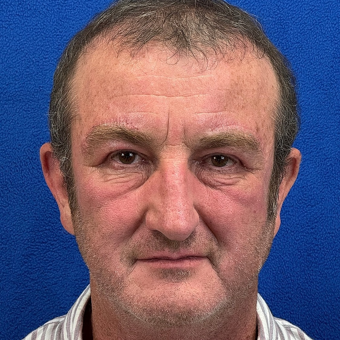 Man with short hair against blue background.